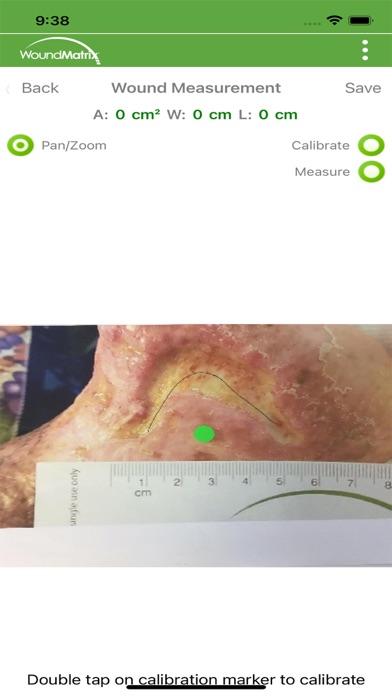 WoundMatrix Lite screenshot 1