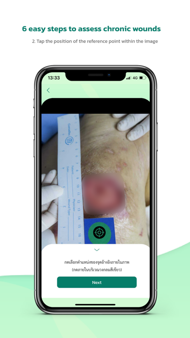 WoundSee screenshot 5