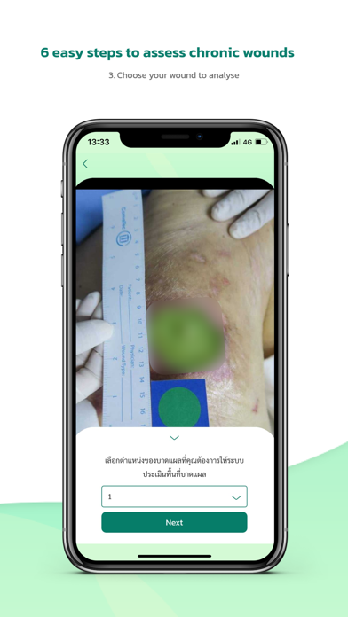 WoundSee screenshot 4