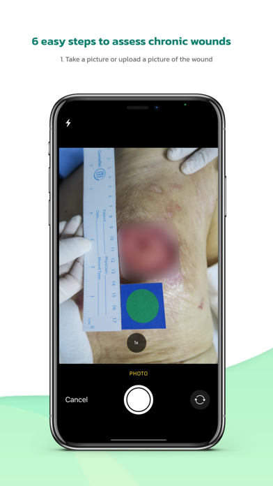 WoundSee screenshot 6