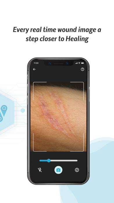 WoundTele: AI Wound Care screenshot 3