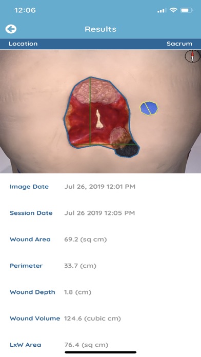 WoundVision Scout Mobile screenshot 2