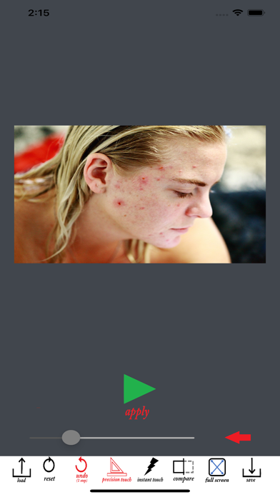 Wrinkle Remover Blemish Editor screenshot 2