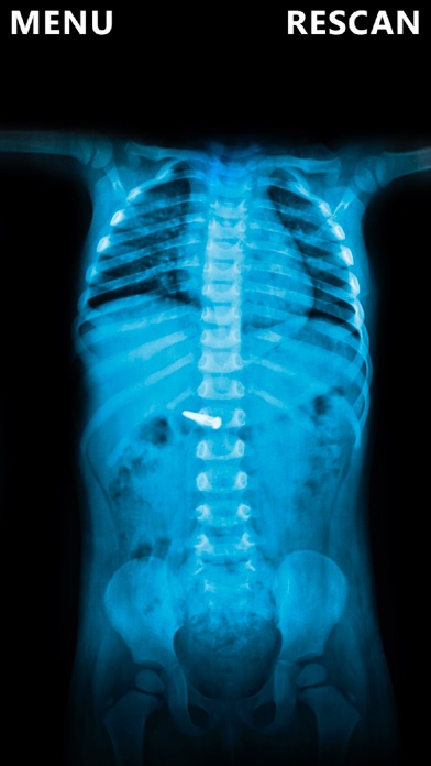 X-Ray Scanner Body Prank screenshot 2