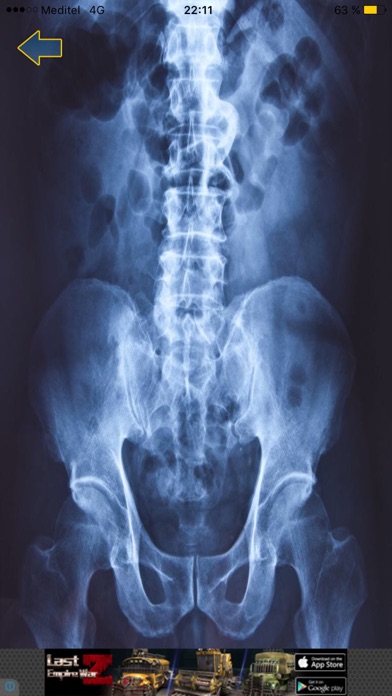 X-ray Scanner body screenshot 1