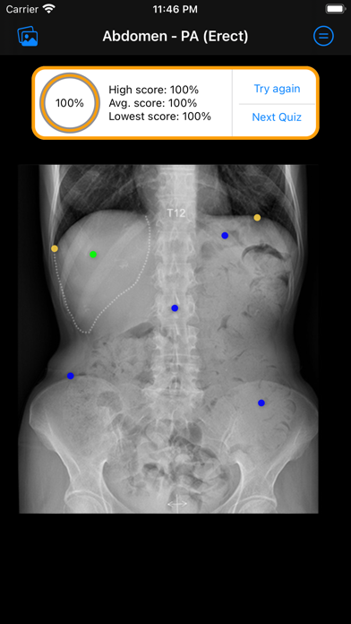Xray Anatomy screenshot 4
