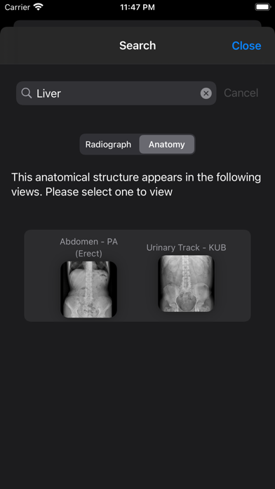 Xray Anatomy screenshot 2