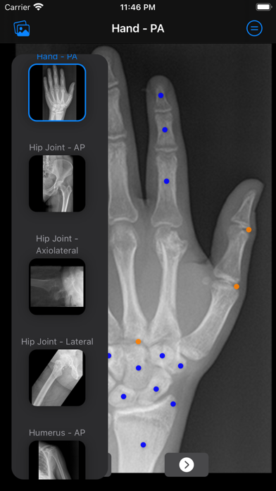 Xray Anatomy screenshot 5