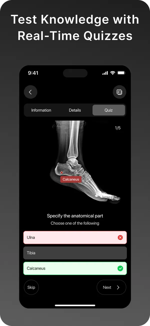 XRay - Sublux Anatomy Learning screenshot 2